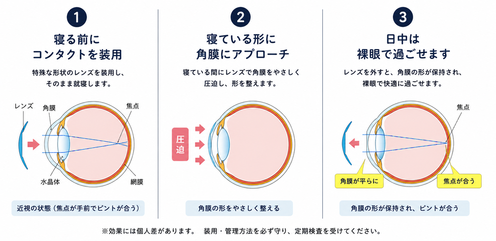目の中では、こんなことが起きています